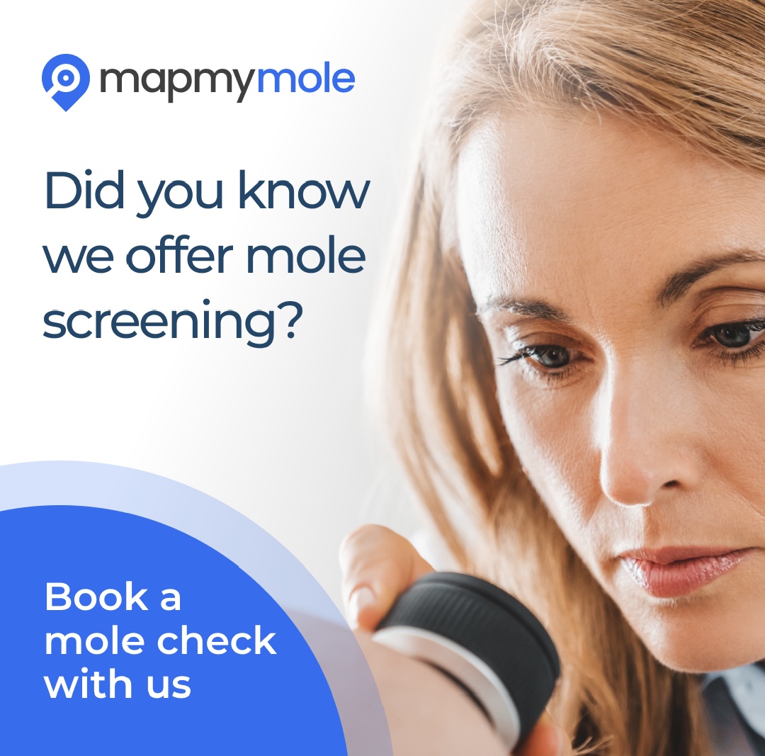 Map my Moles